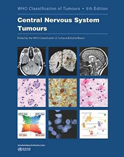 Central Nervous System Tumours: WHO Classification of Tumours 5th Edition by WHO Classification of Tumours Editorial Board | Paperback