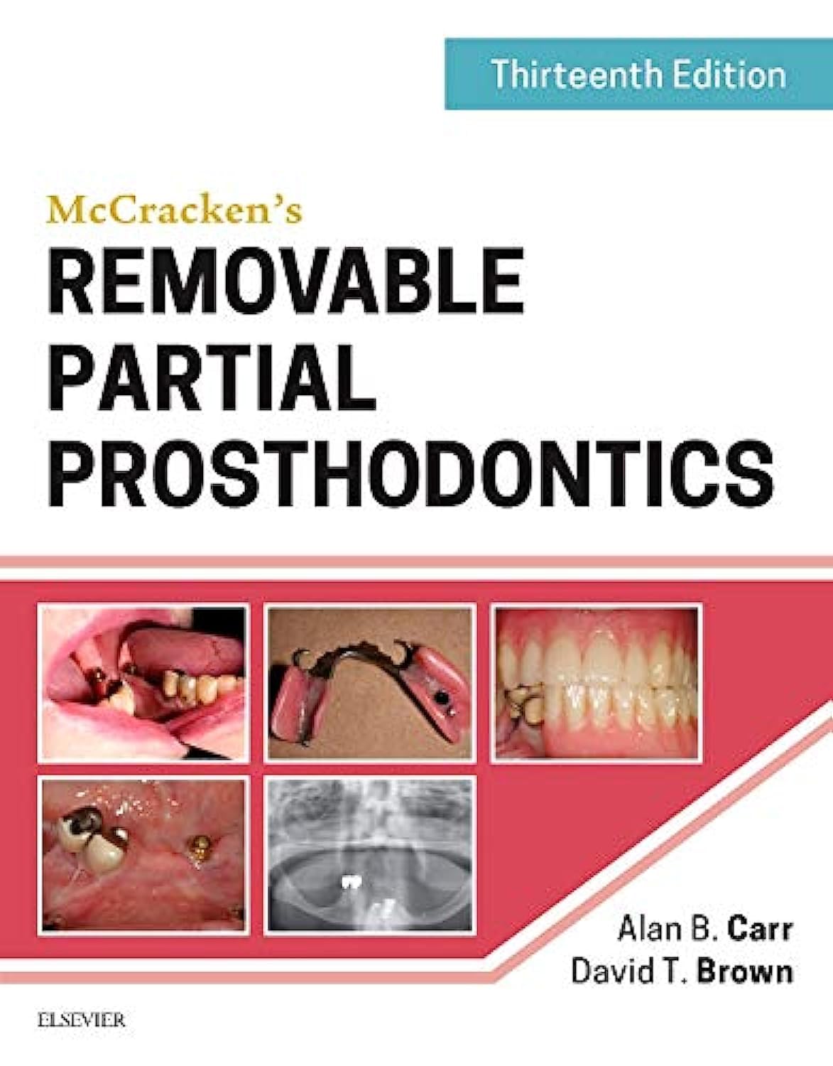 Front cover of the textbook 'McCracken's Removable Partial Prosthodontics' 13th Edition by Alan B. Carr and David T. Brown published by Elsevier, featuring clinical photos of partial dentures.