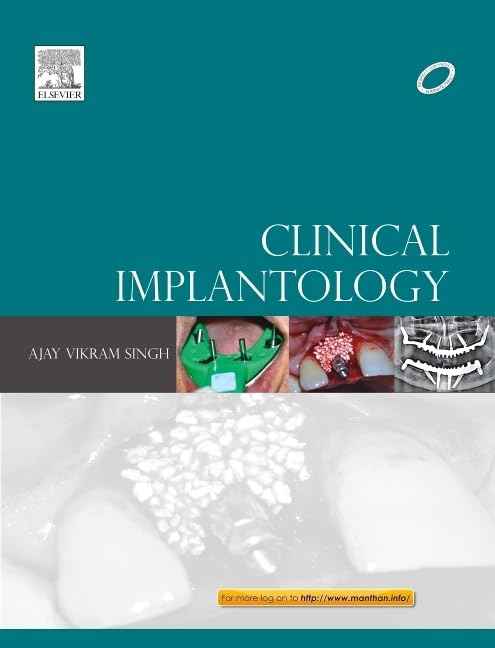 Clinical Implantology 1st Edition – Ajay Vikram Singh |978-8131233245|